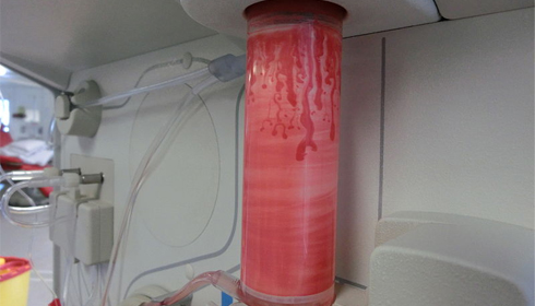 A Centrifugal machine separating plasma after blood donation Pic Courtesy Wikimedia