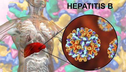 Study Reveals Global Underassessment and Undertreatment of Chronic Hepatitis B Virus